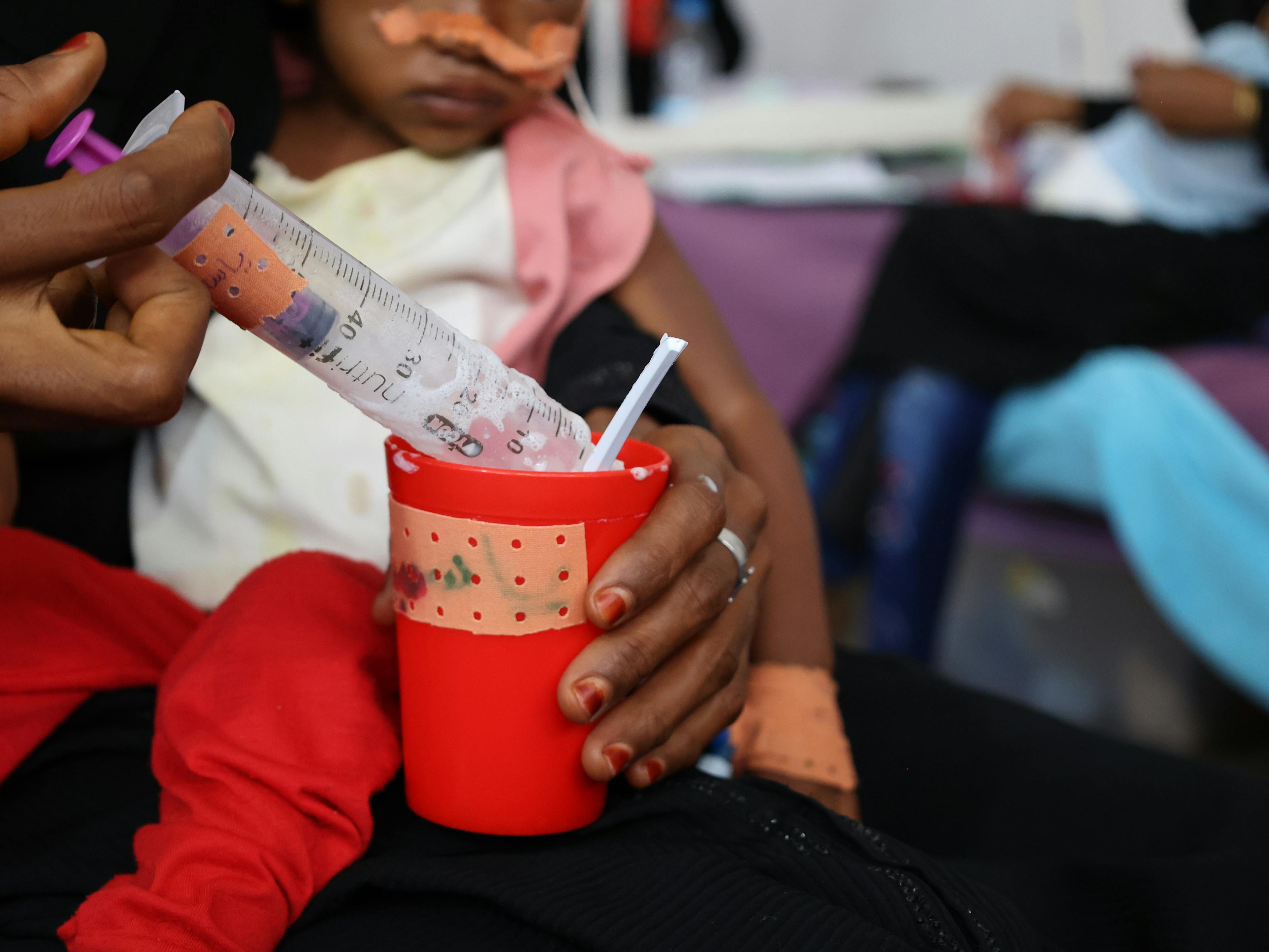 A large syringe loading therapeutic food from a red can, a child on a lap behind.  